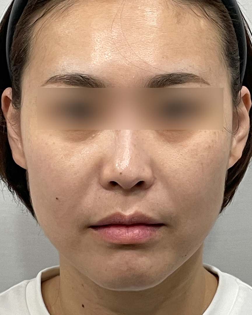 청담디어_온다_전