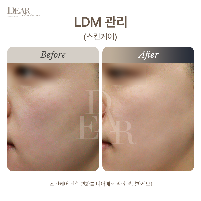 LDM 관리