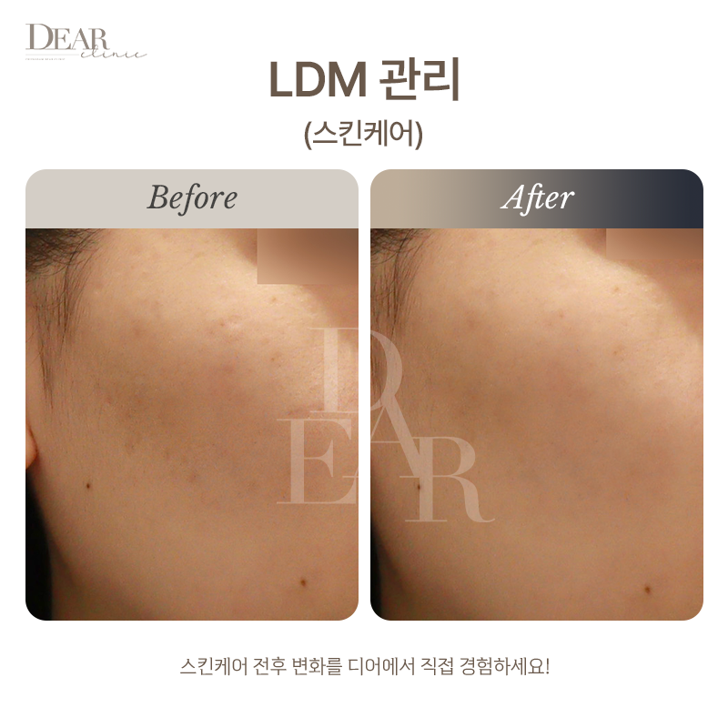 LDM 관리