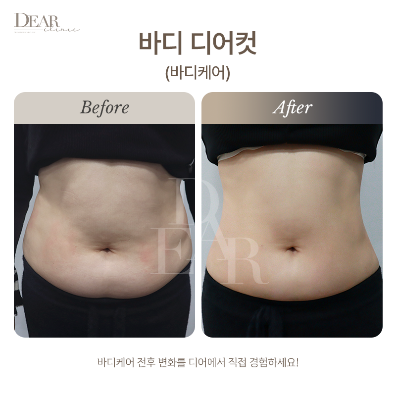 바디 디어컷