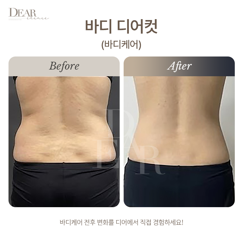 바디 디어컷